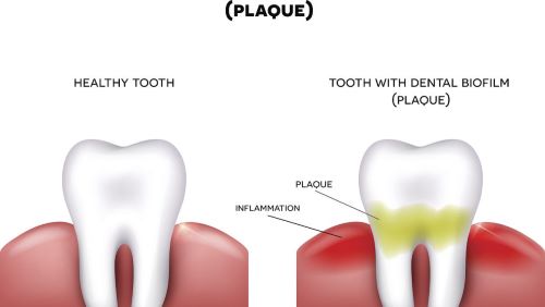 牙科材料如何申請俄羅斯醫療器械注冊證